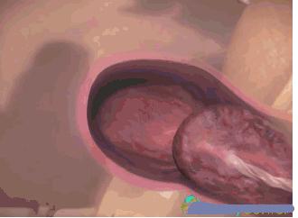 胎儿脑壳大是看哪里,胎儿这么大怎么从产道出来