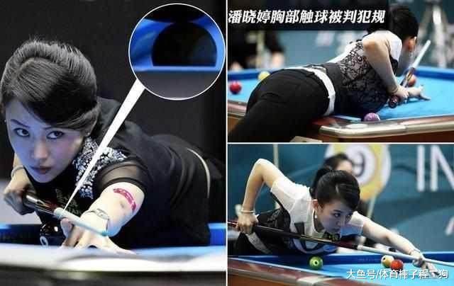 运动员缩胸,网球女运动员缩胸手术