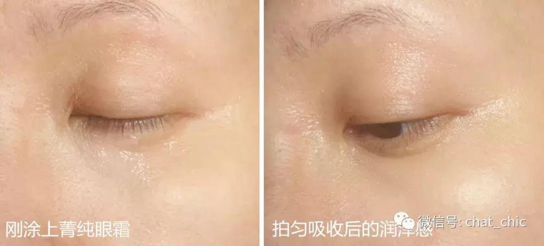 出现第一条鱼尾纹该怎么预防,鱼尾纹是怎么来的