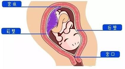 胎盘是前壁好还是后壁好,胎盘一般是前壁还是后壁好