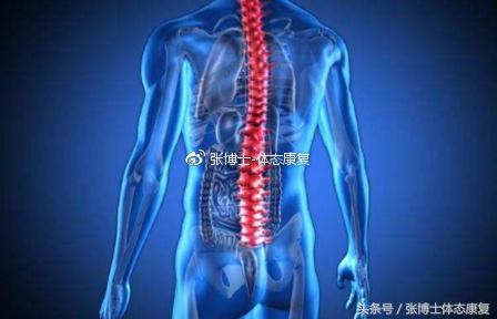 强直性脊柱炎有没有可能完全康复,强直性脊柱炎髋关节粘连康复训练