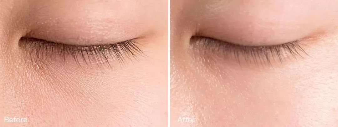 平价眼霜去细纹30岁,30岁以上淡细纹平价眼霜