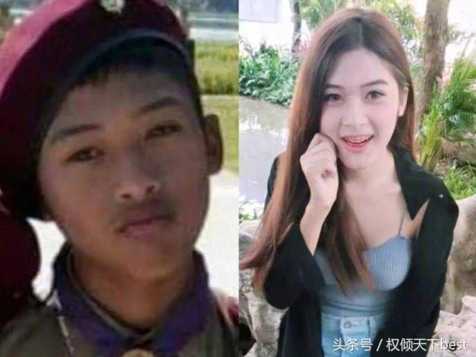 泰国人变性术前后对比,泰国的变性手术是什么原理