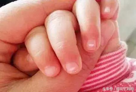 宝宝六个月有虫子了怎么办,八个月宝宝眼睛取出虫子