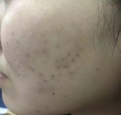 一直被国人瞧不起的老牌国货,老牌国货治好烂脸