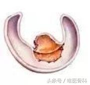 nba半月板损伤都是怎么恢复的,nba球星半月板损伤恢复比较好的