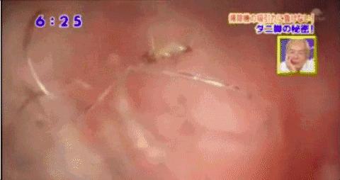 除螨那些事儿,关于除螨的那些事