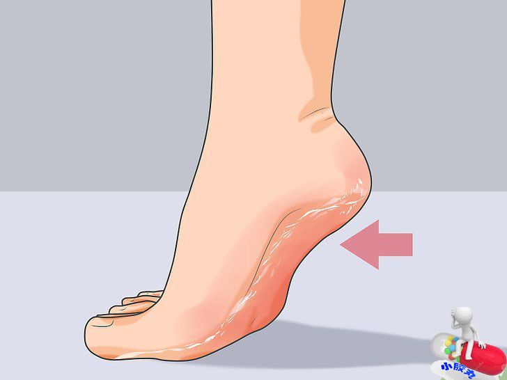 还在为脚臭而发愁吗,这些秘方帮您攻克顽固脚气