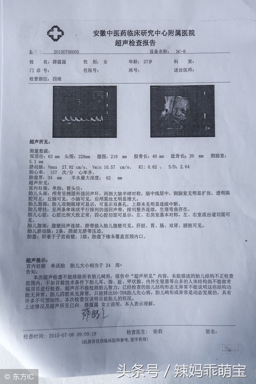 b超说宝宝腿短出生后腿也短,b超说胎儿腿短正常吗