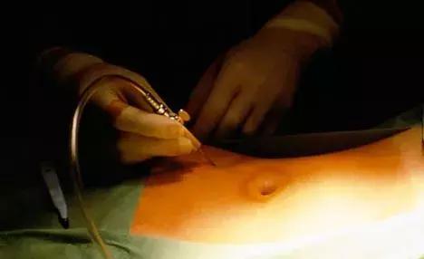 “17岁少女7000元*市黑**卖卵”刷屏，“疼哭”还不是最可怕的