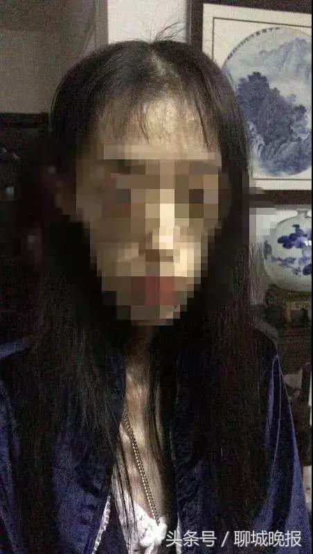 21岁女孩自杀式减肥：1米67才50斤，脑组织如60岁！照片不忍直视