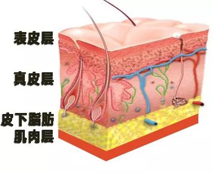 瘦了200斤，身体很多赘皮，怎么办？