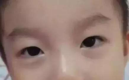 小孩湿气重怎么调理最快,脾胃虚寒湿气重怎么调理炖什么汤