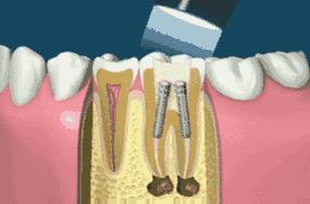 别让你的牙齿受罪,别让你的牙齿受委屈