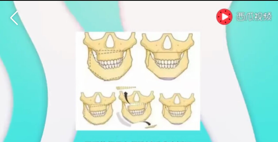 人脸歪了怎么调整,人脸是歪的怎么办