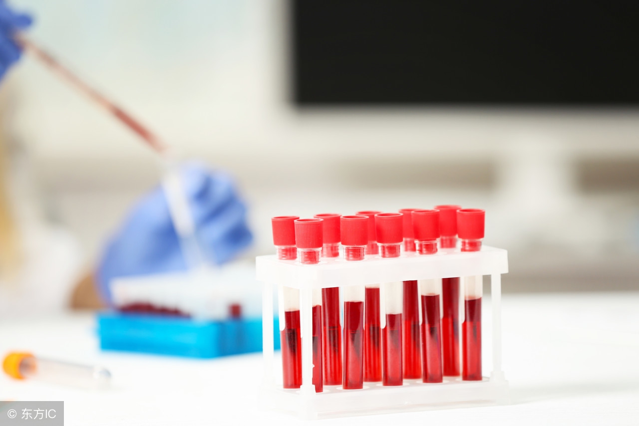 血标本凝结的原因分析,血标本有凝块怎么回事
