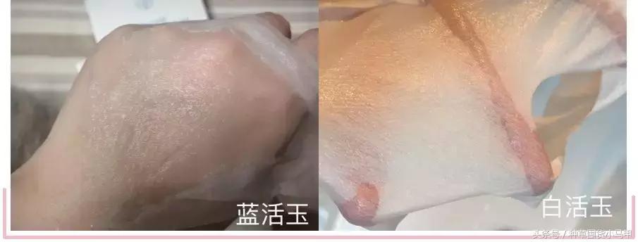朋友圈狂推的“十项全能”医美面膜，用不对烂脸更严重！
