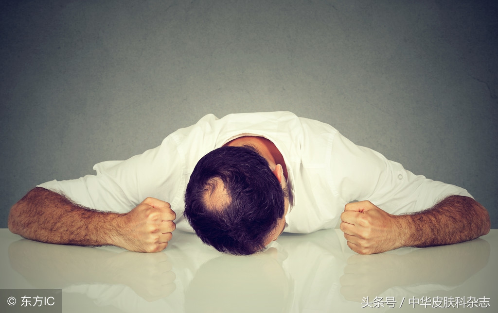 怎么判断脱发还是断发,如何判断是脱发还是掉发