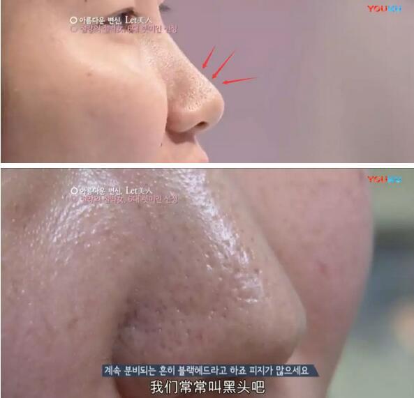 生完孩子被老公嫌弃太胖后续,生完孩子以后肚皮被老公嫌弃