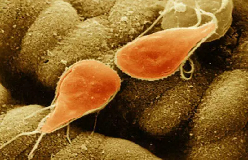 隐形眼镜硬知识,隐形眼镜的全部知识