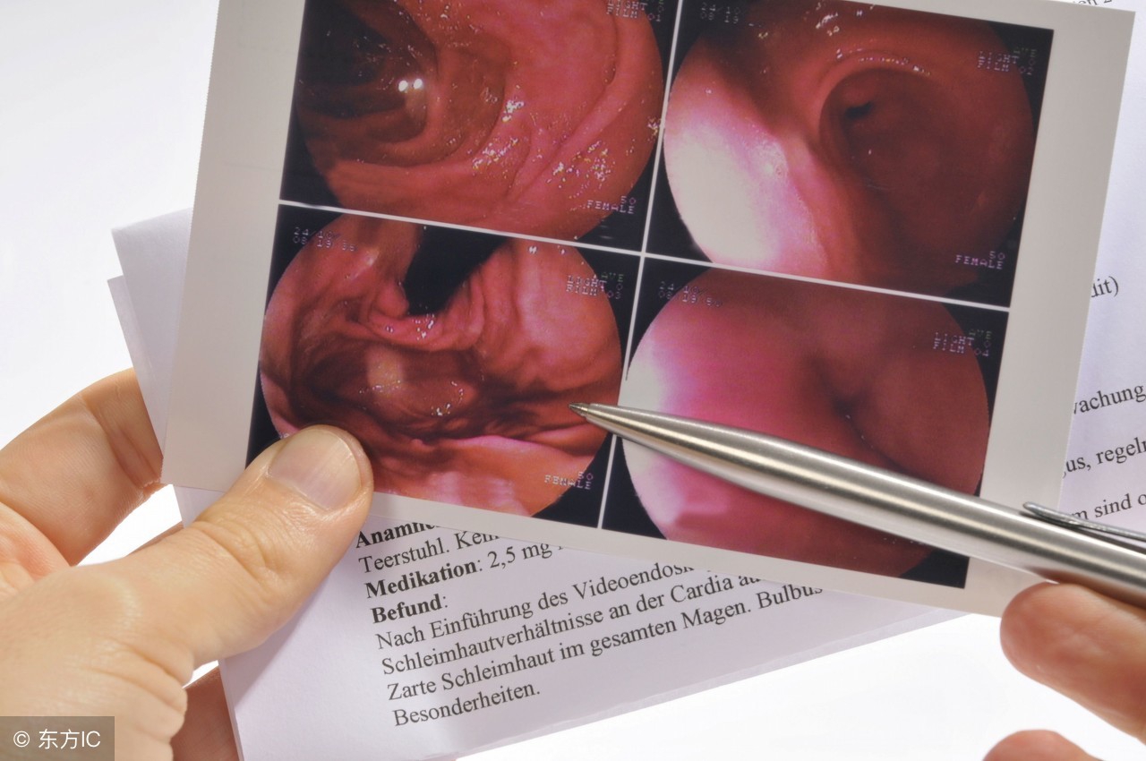 为什么腹部痛医生就让你做肠胃镜,为什么医生要建议你做胃镜检查