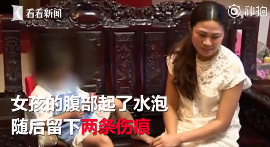 冰淇淋对宝宝有危害吗,网红冰淇淋冻伤小孩