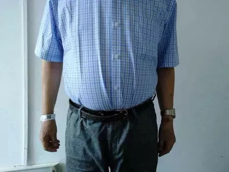 天呐！大爷3年吃掉100多支“皮炎平”软膏！