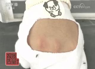 防蚊贴可以驱赶蚊子吗 (防蚊贴蚊子会离你远远的)