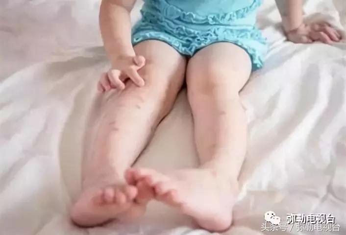 弥勒蚊虫消杀,弥勒病媒消杀