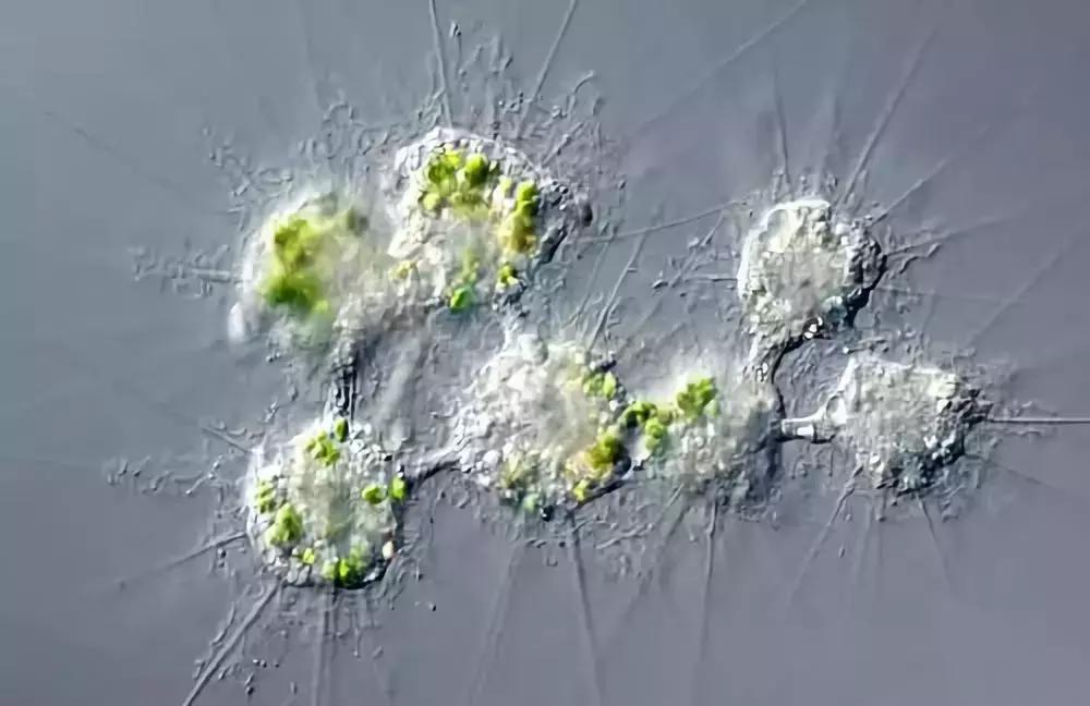 狂犬病发作3个阶段，6天内死亡和狂犬病人爱爱会被传染吗