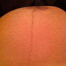 婴儿彩超胎动高清视频,婴儿胎动视频