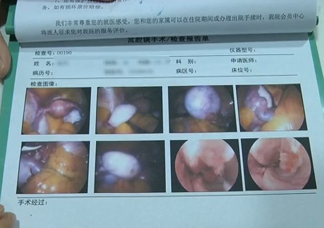 未婚女孩体内发现头发和骨头,22岁未婚女孩月经不正常是咋回事