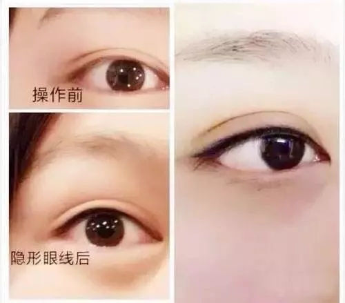 美瞳线的魅力图片大全,美瞳线的美感