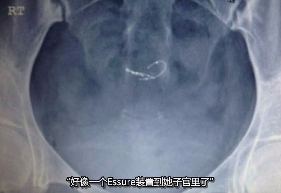 “*交性**意味着死亡”医疗行业背后的真相让人毛骨悚然