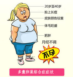 肖承悰治疗卵巢囊肿经验,多囊卵巢综合征诊治指南2022