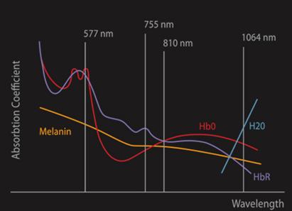 冰肌嫩肤脱毛,超冰脱毛介绍