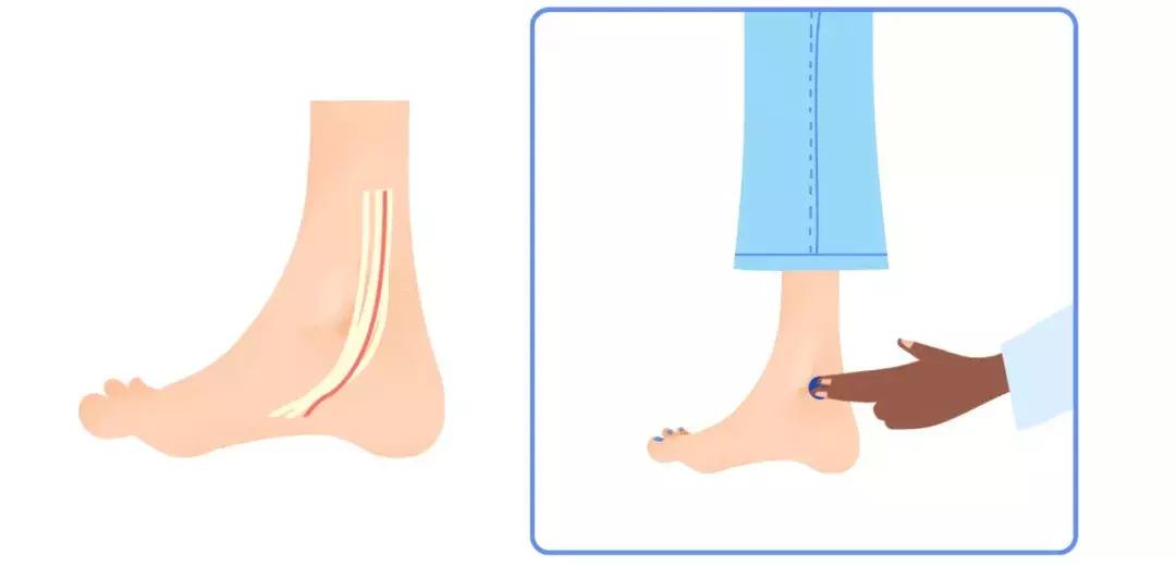 手腕测脉搏的方法,测脉搏的部位是哪里图