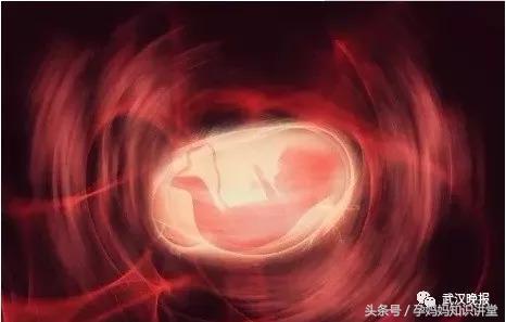 怀了双胞胎,却只生下一个宝宝,医生提醒这是“产科风险之王”