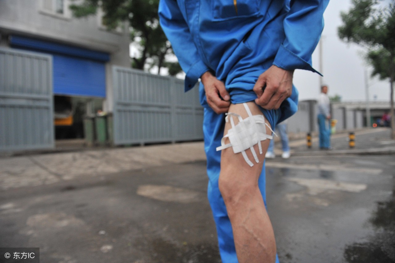 被蜈蚣咬伤后的急救方法,如何判断是否被蜈蚣咬伤