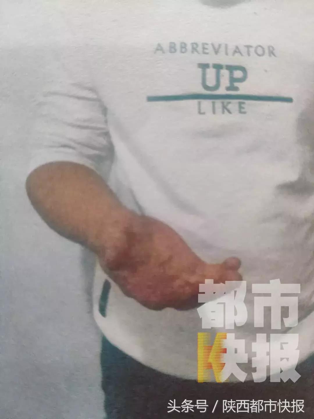 突然反目！礼泉一男子被朋友挟持到水库拘禁脱衣殴打，就因为他