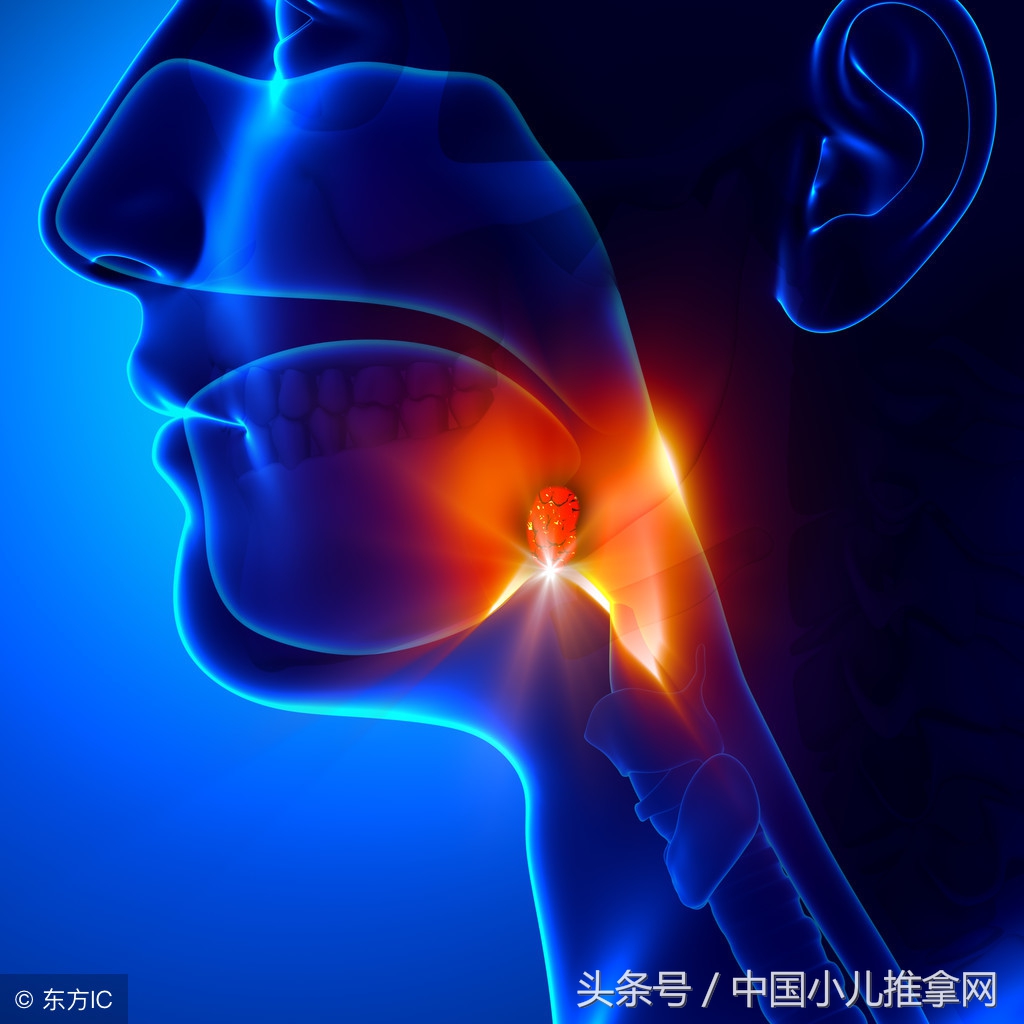 小儿扁桃体化脓发烧的推拿手法,小孩化脓性扁桃体炎推拿手法