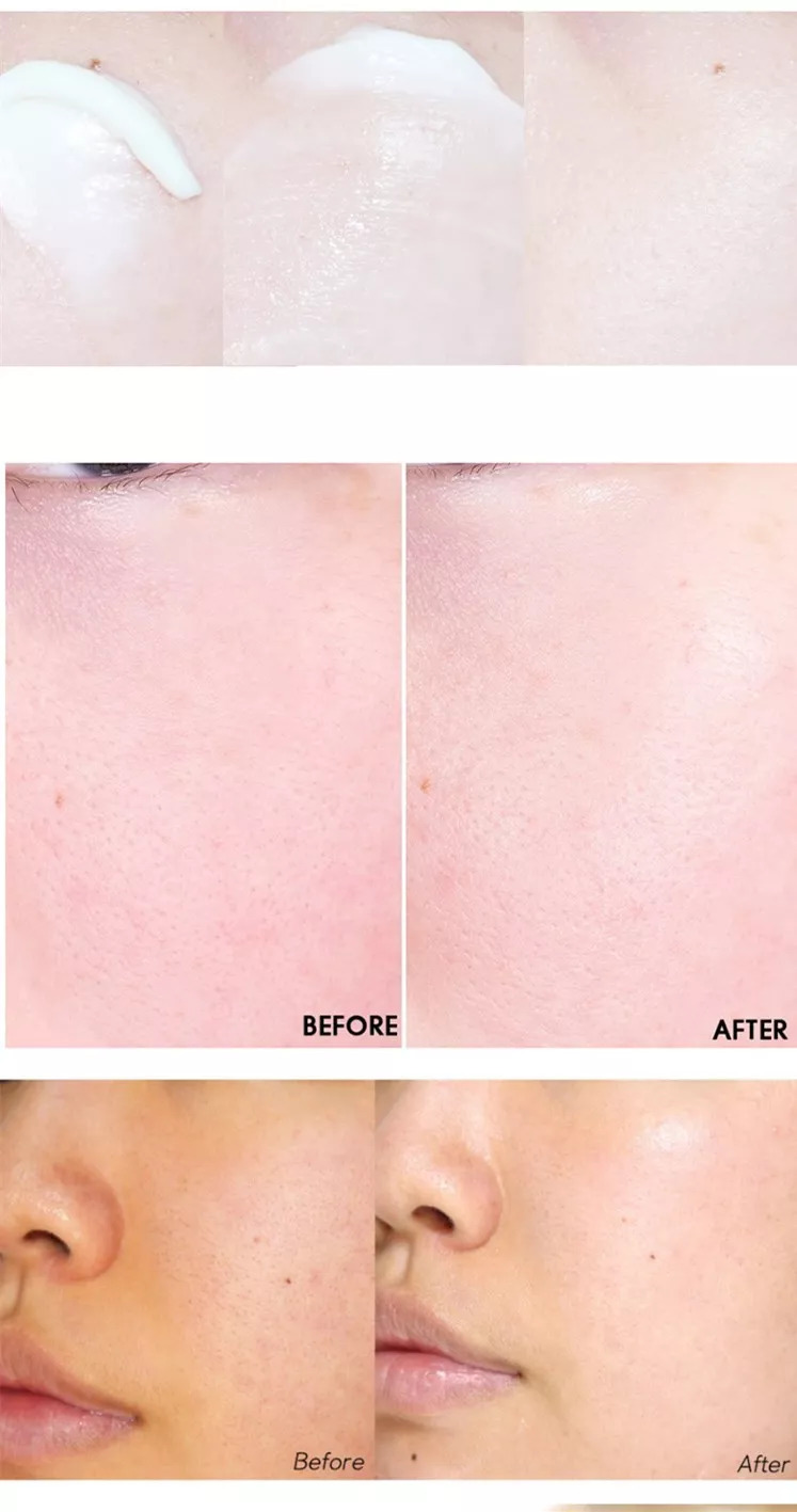 韩国东星小黑瓶祛斑霜,东星祛斑霜为什么用了斑多