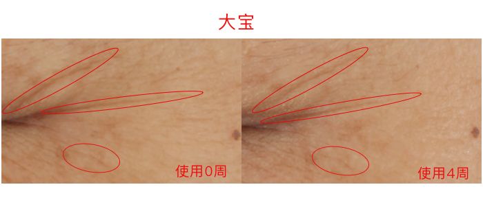lamer眼霜和sk2,40-50眼霜测评