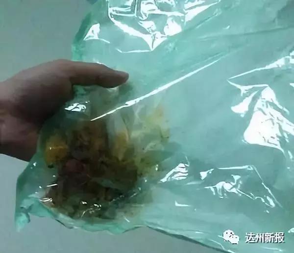 男子手术后发现纱布,手术伤口愈合边缘有条白线