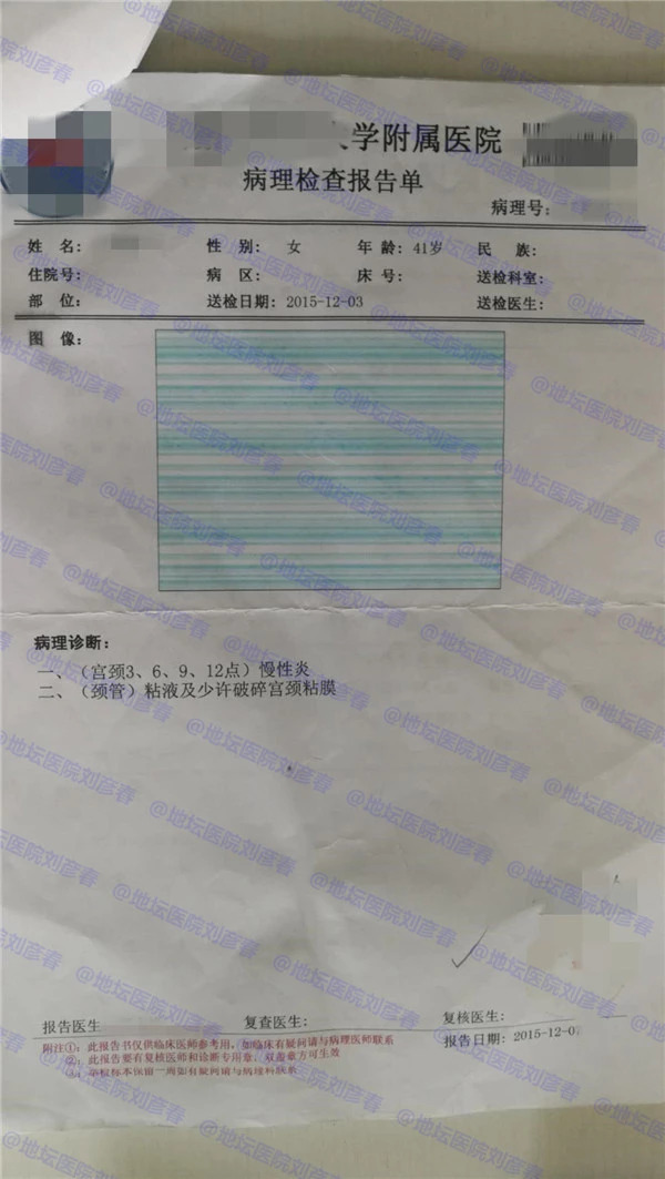 hpv持续感染多久会癌前病变,hpv持续感染但是tct正常