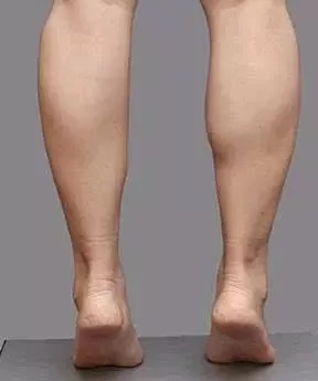 小腿肌肉太粗怎样瘦下来,肌肉型小腿粗壮如何变细腿