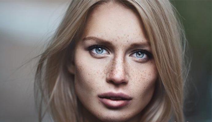 脸颊两边有斑是什么斑怎么去掉,脸颊两边长色斑什么原因导致的