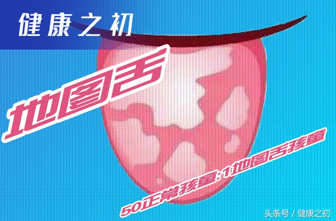 警惕这5种疾病,儿童罕见病名单及病症25种