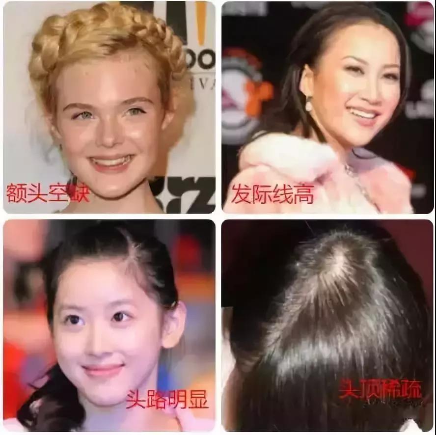 头发变薄怎么护发,头发变薄适合什么样发型