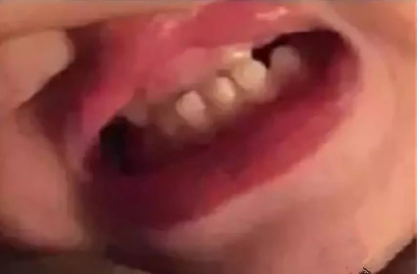 2岁宝宝牙齿全烂光，这5个问题不及时处理，孩子将来恨你一辈子